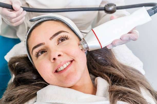 Radio frequency micro needling machine hand piece on the cheek of a woman's face during a beauty skin tightening treatment.